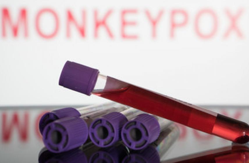 В Турции подтвердили первый случай заболевания оспой обезьян