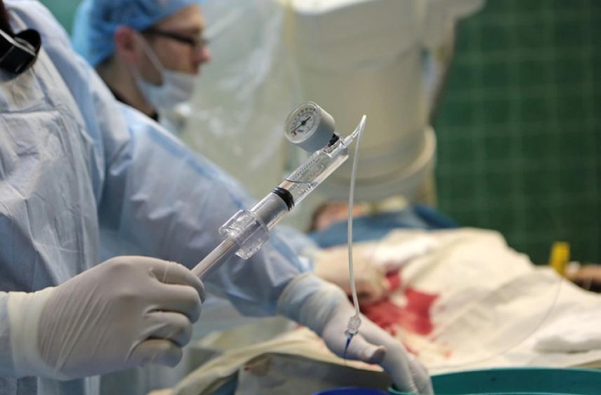 Мужчина на спор проглотил зажигалку и 35 лет проходил с ней в желудке